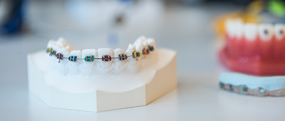 Zahnspange in Hattingen für gerade Zähne | Kieferorthopädie